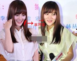 整容医生爆料视频大全集,医生爆料视频大全集深度解析  第2张